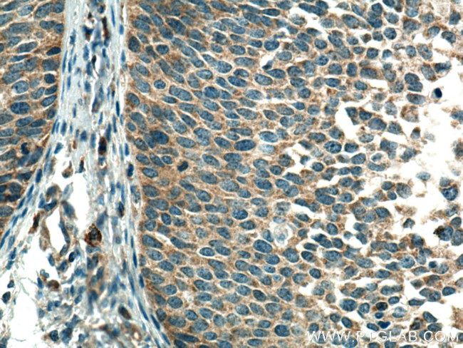 CSAD Antibody in Immunohistochemistry (Paraffin) (IHC (P))