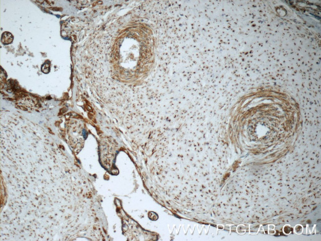 B3GNT7 Antibody in Immunohistochemistry (Paraffin) (IHC (P))