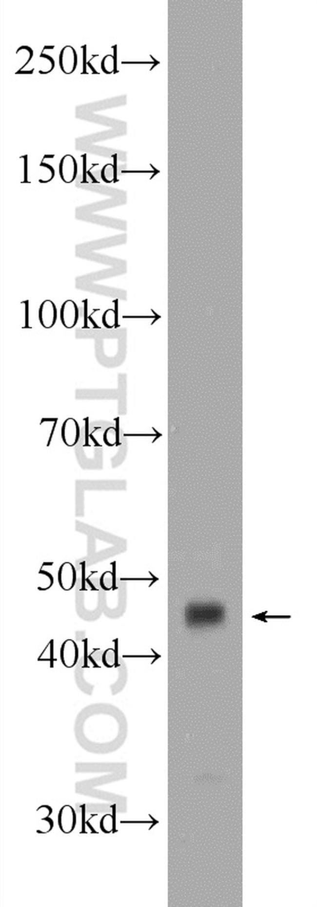 B3GNT7 Antibody in Western Blot (WB)