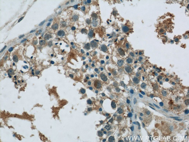 MEX3C Antibody in Immunohistochemistry (Paraffin) (IHC (P))