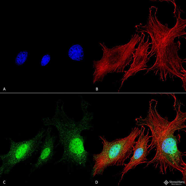 BNIP3 Antibody in Immunocytochemistry (ICC/IF)