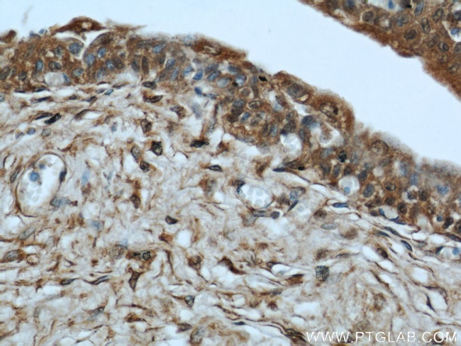 MYBPC1 Antibody in Immunohistochemistry (Paraffin) (IHC (P))