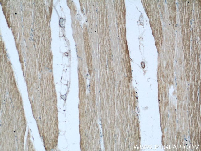 MYBPC1 Antibody in Immunohistochemistry (Paraffin) (IHC (P))