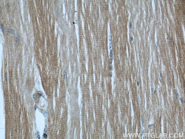 MYBPC1 Antibody in Immunohistochemistry (Paraffin) (IHC (P))