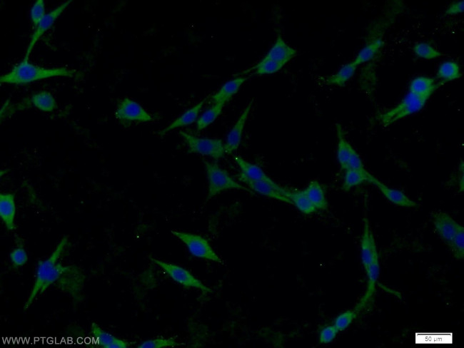 Caspase 1/p20/p10 Antibody in Immunocytochemistry (ICC/IF)