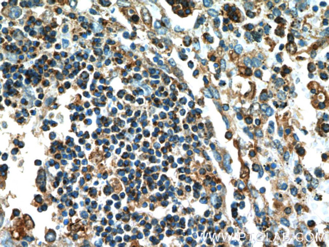 Caspase 1/p20/p10 Antibody in Immunohistochemistry (Paraffin) (IHC (P))