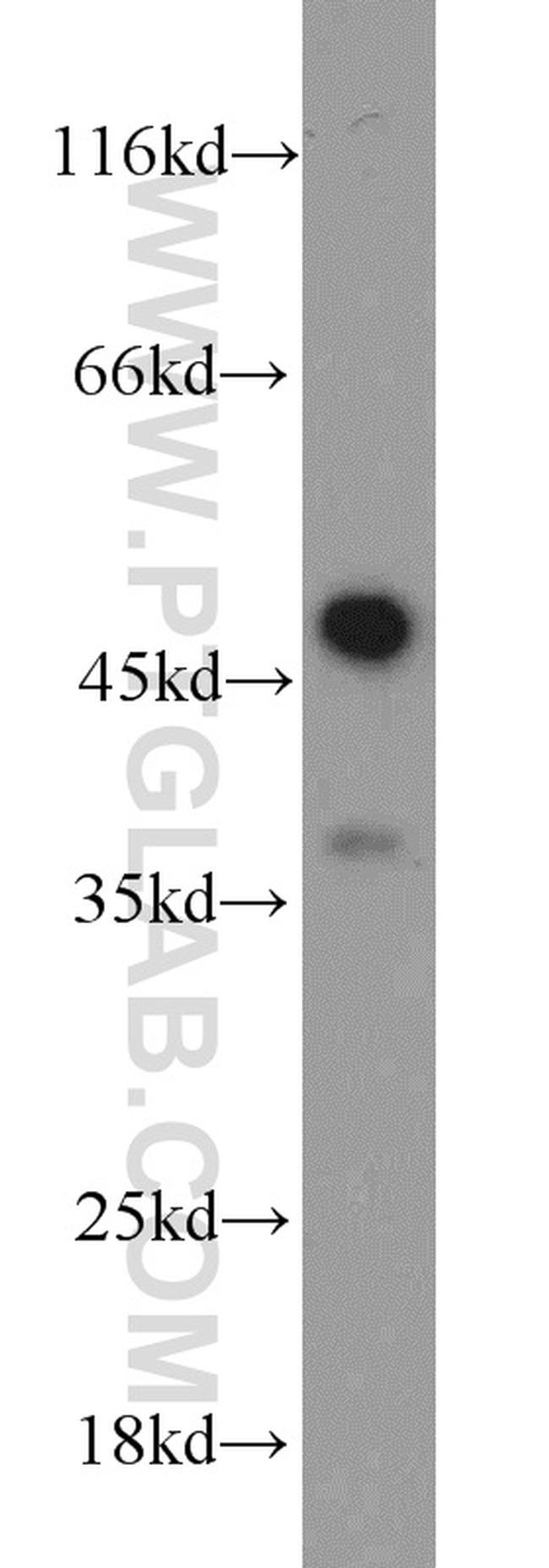 Caspase 1/p20/p10 Antibody in Western Blot (WB)