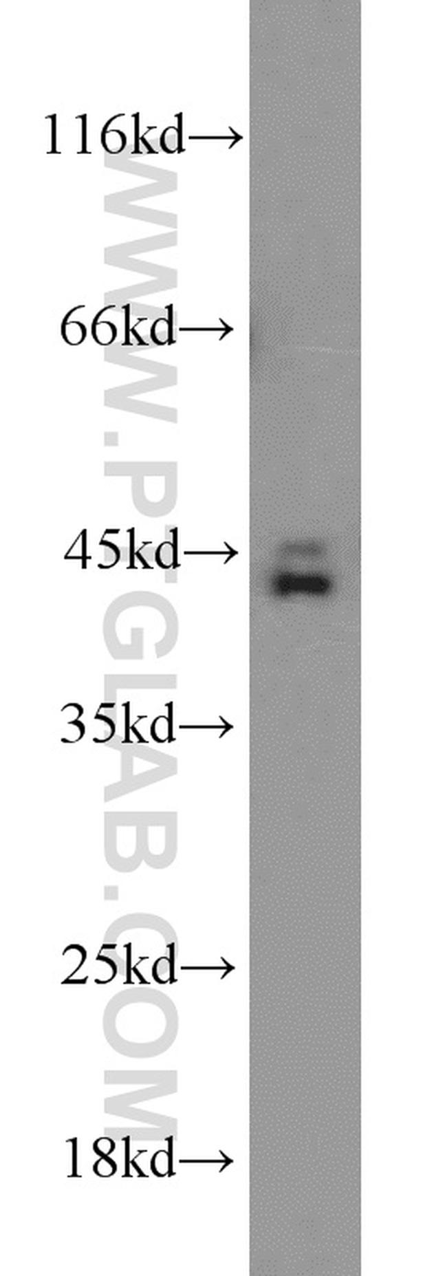 Caspase 1/p20/p10 Antibody in Western Blot (WB)