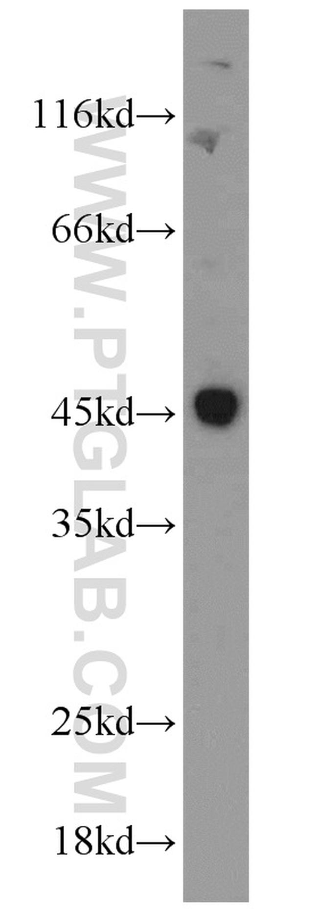 Caspase 1/p20/p10 Antibody in Western Blot (WB)