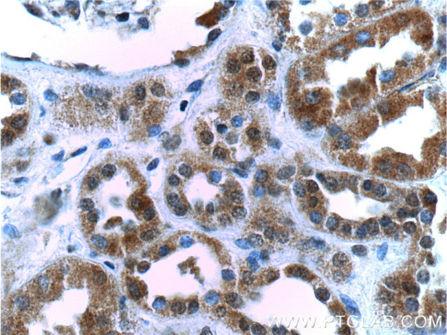 SIX5 Antibody in Immunohistochemistry (Paraffin) (IHC (P))