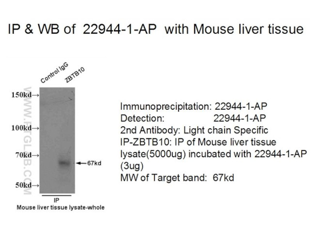 ZBTB10 Antibody in Immunoprecipitation (IP)