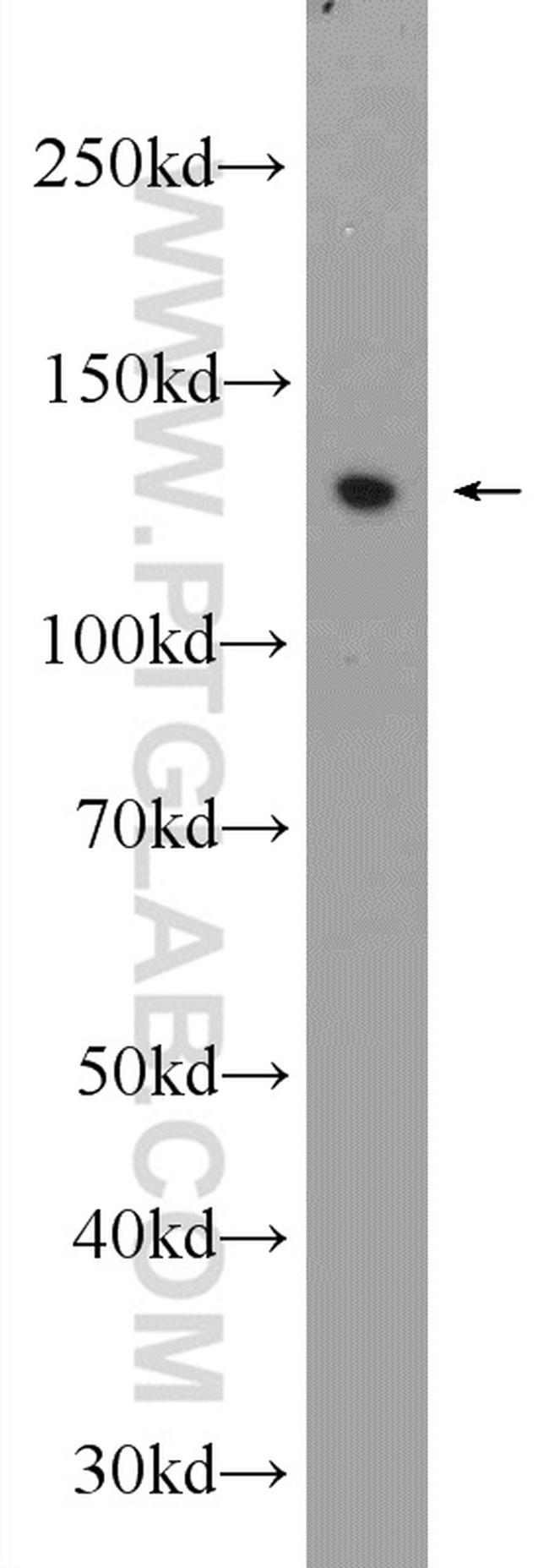 ZBTB10 Antibody in Western Blot (WB)