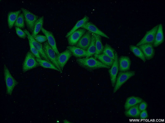 Osteopontin Antibody in Immunocytochemistry (ICC/IF)