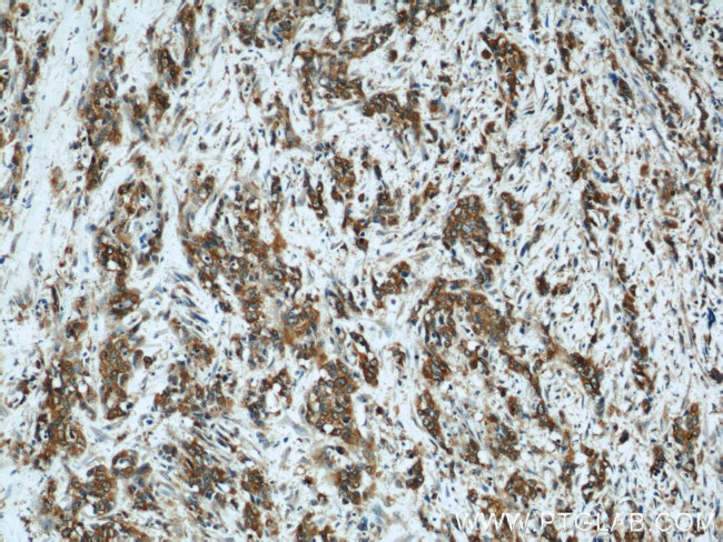 Osteopontin Antibody in Immunohistochemistry (Paraffin) (IHC (P))