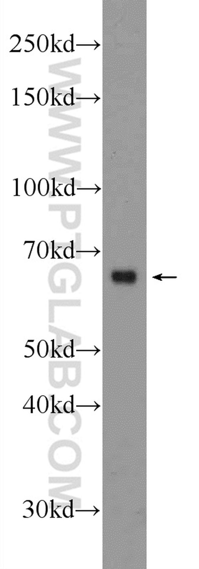 Osteopontin Antibody in Western Blot (WB)