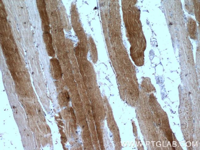 PRODH Antibody in Immunohistochemistry (Paraffin) (IHC (P))