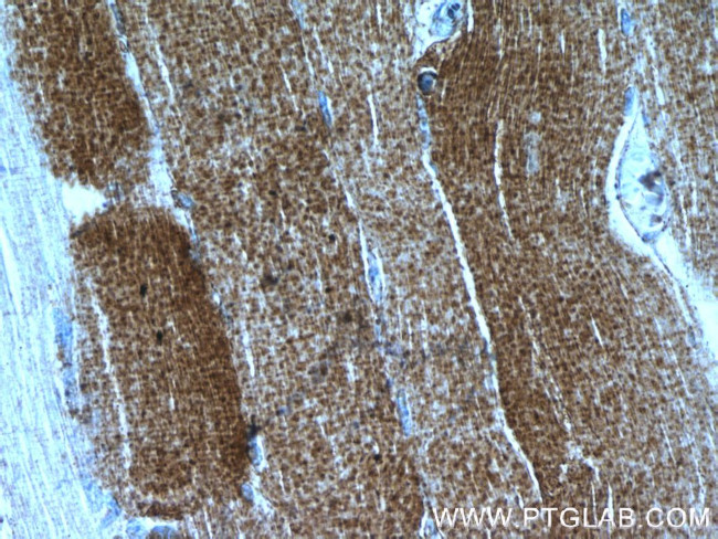 PRODH Antibody in Immunohistochemistry (Paraffin) (IHC (P))