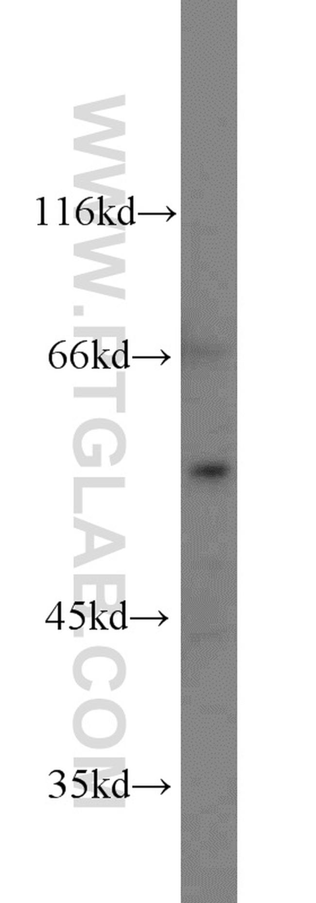 PRODH Antibody in Western Blot (WB)