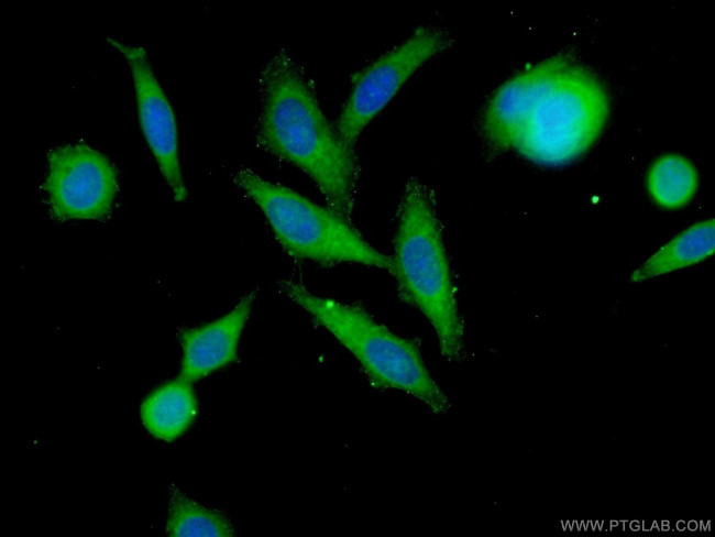 MMP12 Antibody in Immunocytochemistry (ICC/IF)