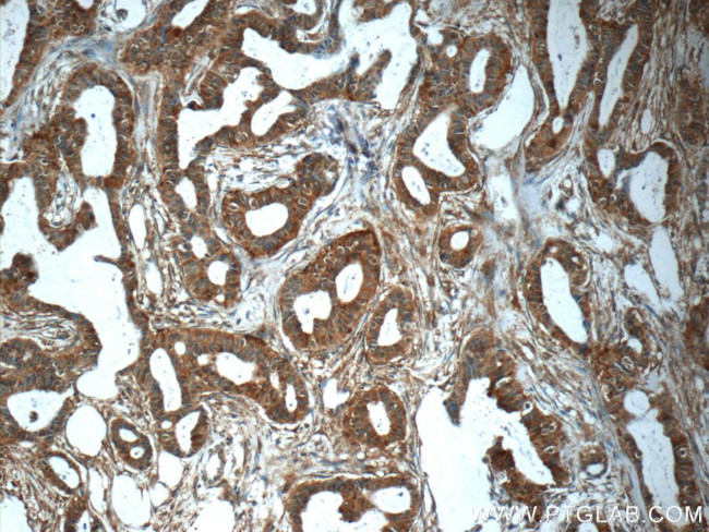 MMP12 Antibody in Immunohistochemistry (Paraffin) (IHC (P))