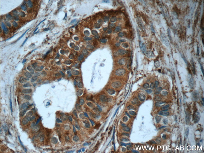 MMP12 Antibody in Immunohistochemistry (Paraffin) (IHC (P))