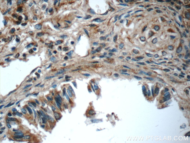 MMP12 Antibody in Immunohistochemistry (Paraffin) (IHC (P))