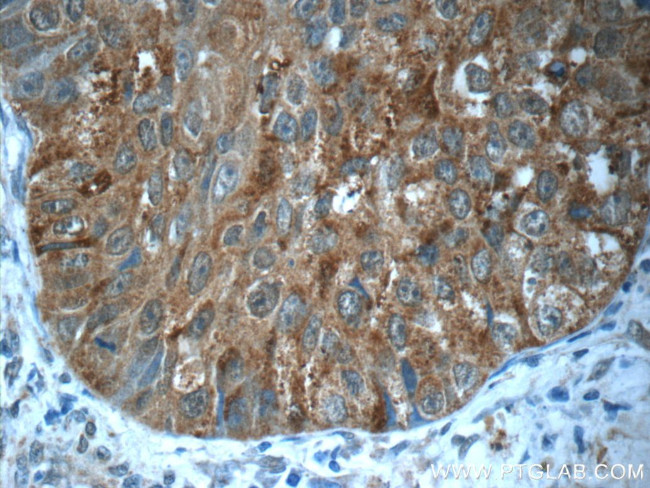 MMP12 Antibody in Immunohistochemistry (Paraffin) (IHC (P))