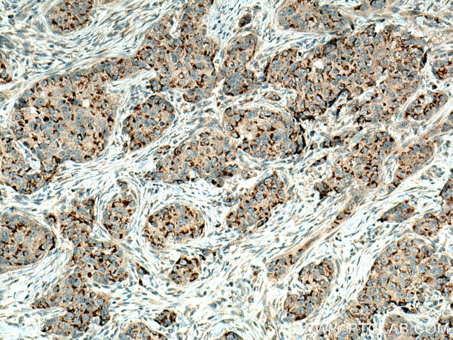 MMP12 Antibody in Immunohistochemistry (Paraffin) (IHC (P))