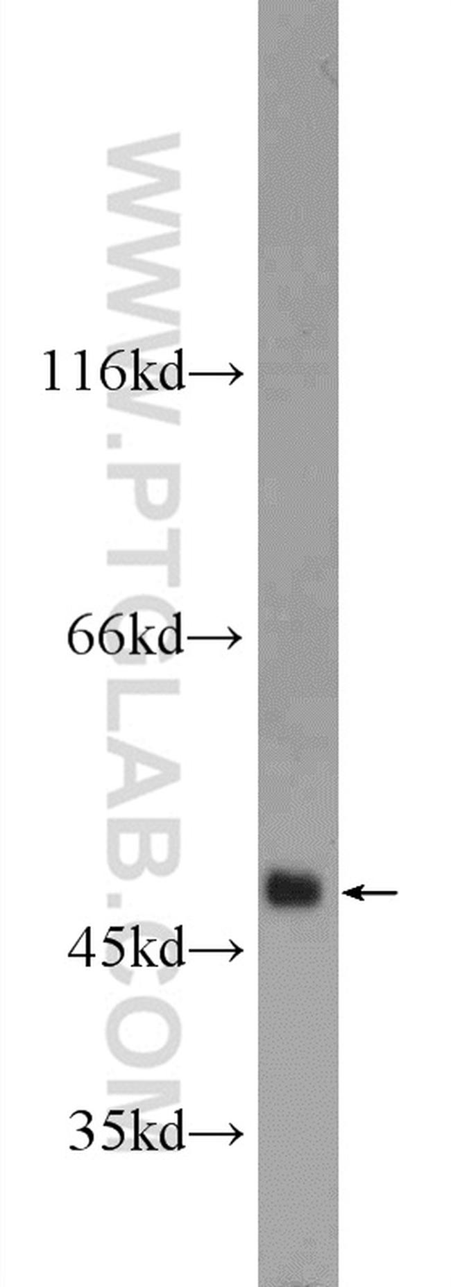 MMP12 Antibody in Western Blot (WB)