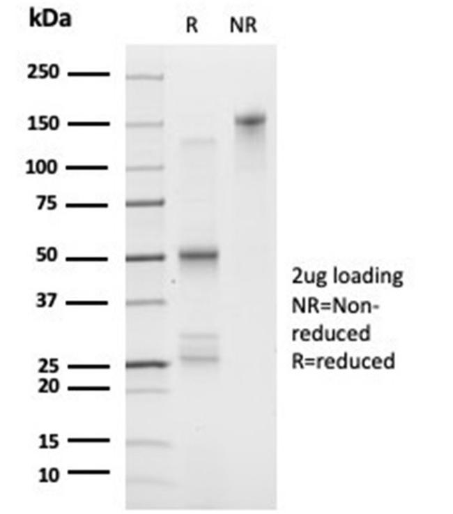 FOXL1/Forkhead Box Protein L1 (Transcription Factor) Antibody in Immunoelectrophoresis (IE)