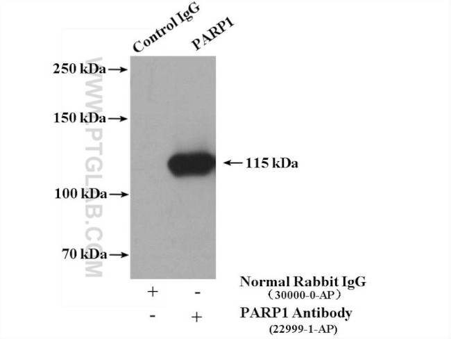 PARP1 Antibody in Immunoprecipitation (IP)