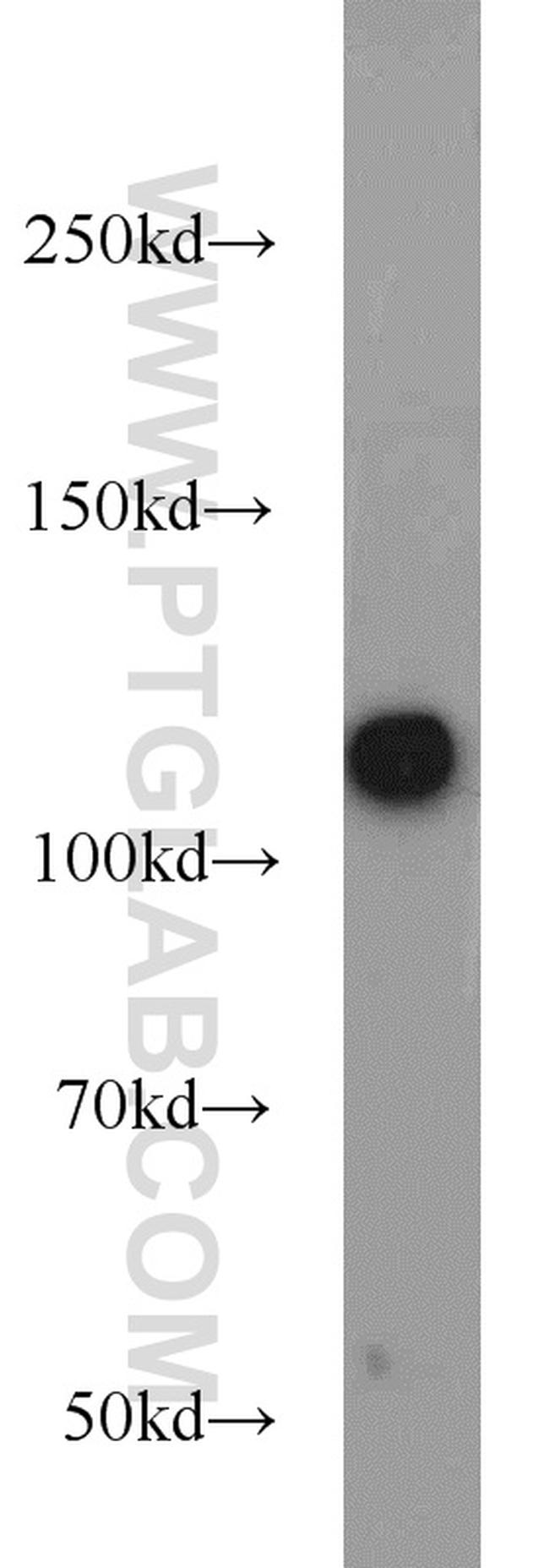 PARP1 Antibody in Western Blot (WB)