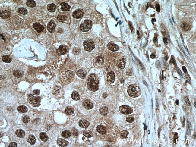 PARP1 Antibody in Immunohistochemistry (Paraffin) (IHC (P))