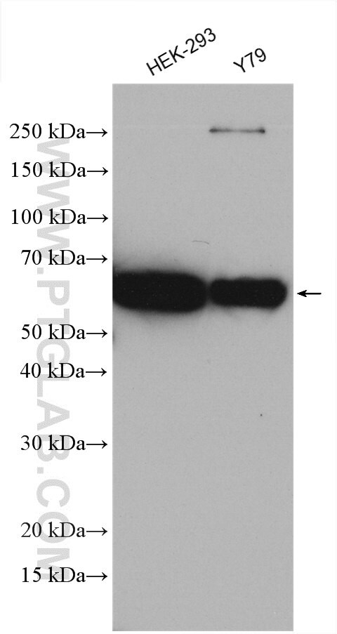 SORCS1 Antibody in Western Blot (WB)