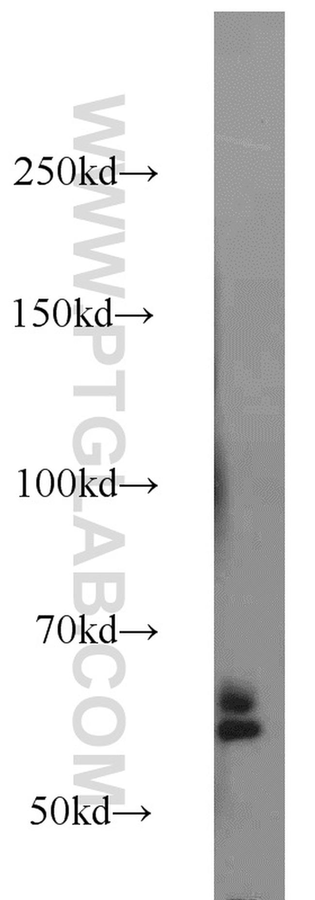 SORCS1 Antibody in Western Blot (WB)