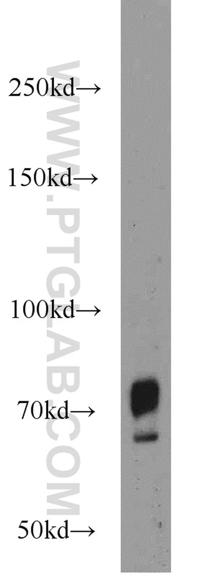 SORCS1 Antibody in Western Blot (WB)