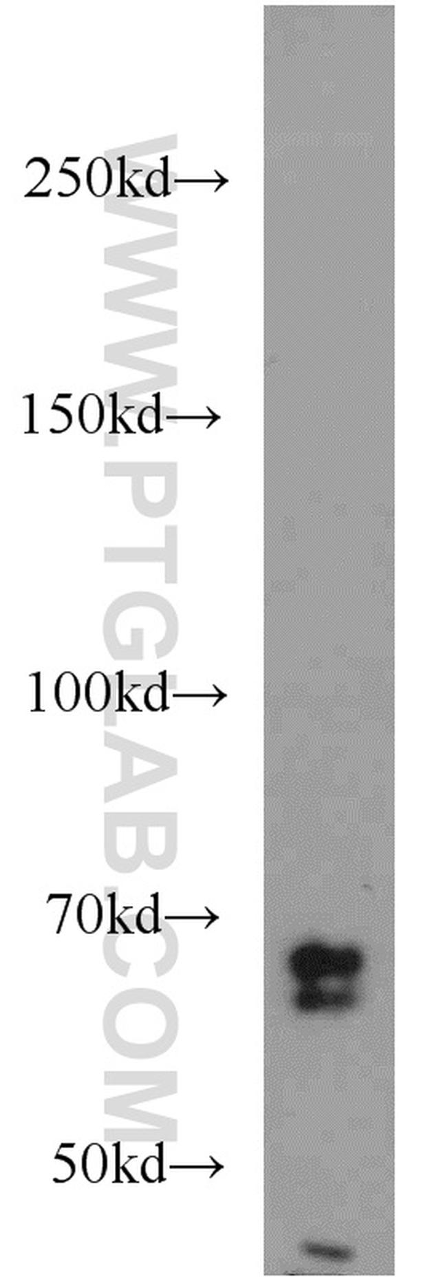 SORCS1 Antibody in Western Blot (WB)