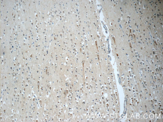 SORCS1 Antibody in Immunohistochemistry (Paraffin) (IHC (P))