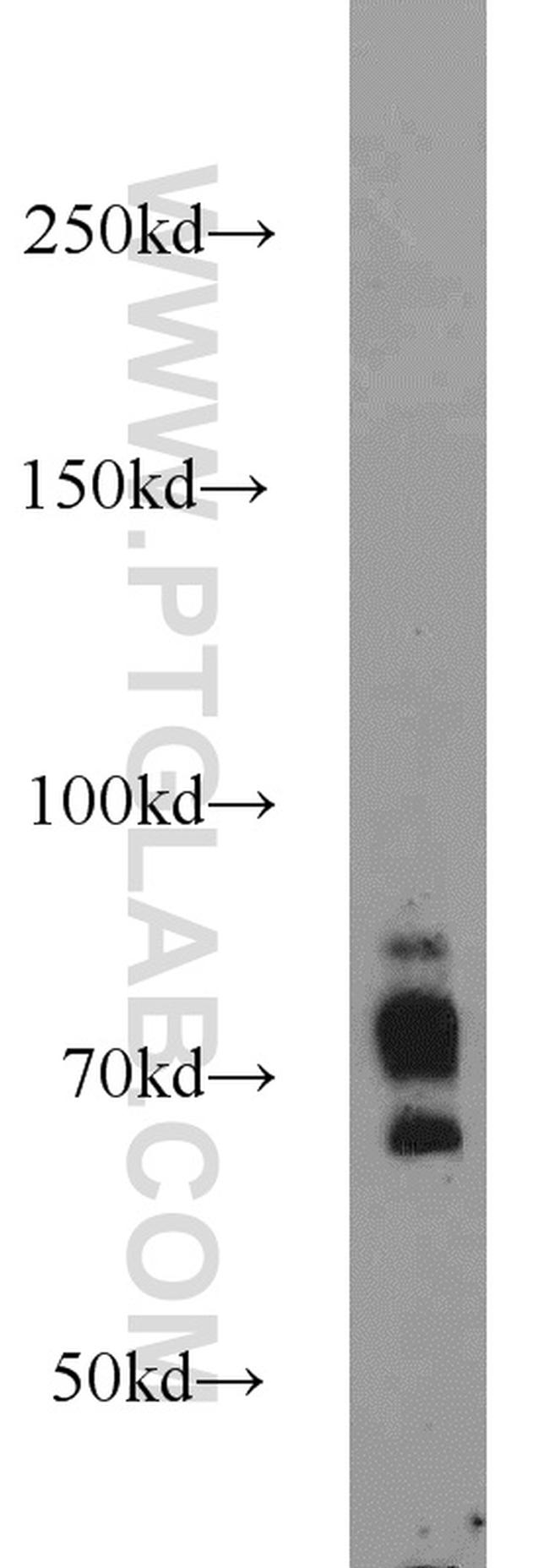 SORCS1 Antibody in Western Blot (WB)