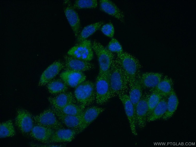 SCP2 Antibody in Immunocytochemistry (ICC/IF)