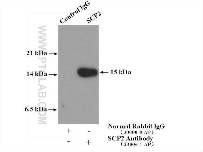 SCP2 Antibody in Immunoprecipitation (IP)