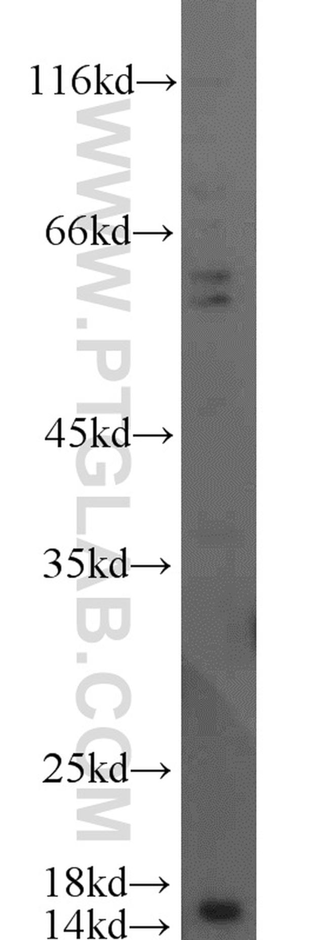 SCP2 Antibody in Western Blot (WB)