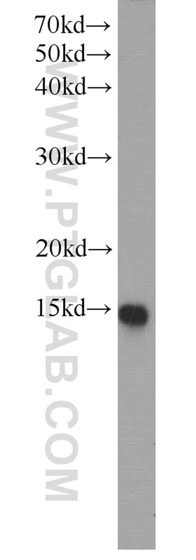 SCP2 Antibody in Western Blot (WB)