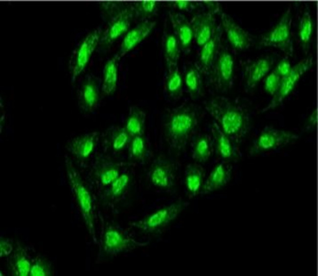 Atg12 Antibody in Immunocytochemistry (ICC/IF)