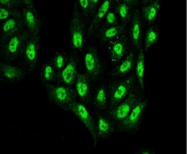 Atg12 Antibody in Immunocytochemistry (ICC/IF)