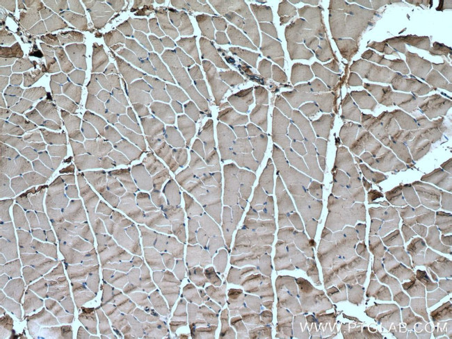 Nav1.5 Antibody in Immunohistochemistry (Paraffin) (IHC (P))