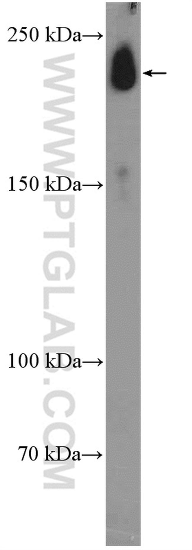 Nav1.5 Antibody in Western Blot (WB)