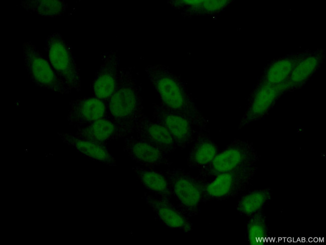 SCP3 Antibody in Immunocytochemistry (ICC/IF)