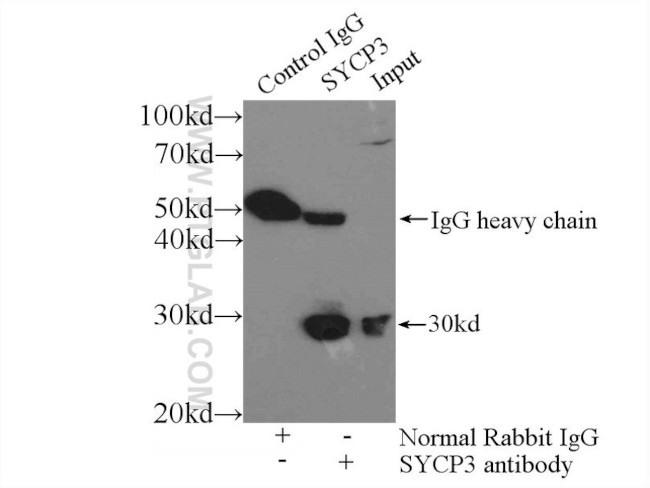 SCP3 Antibody in Immunoprecipitation (IP)