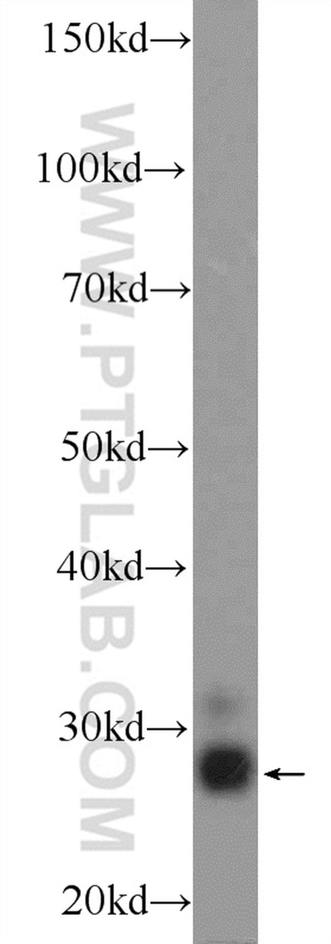 SCP3 Antibody in Western Blot (WB)